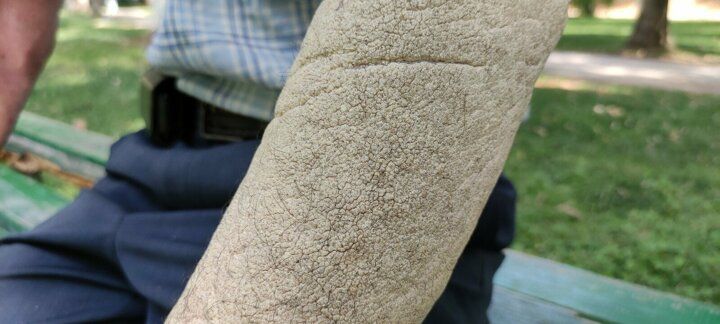 Hayatı kabusa döndü! Görenlerin kaçmasına alışamadı 3