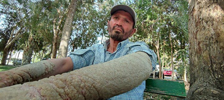 Hayatı kabusa döndü! Görenlerin kaçmasına alışamadı 5