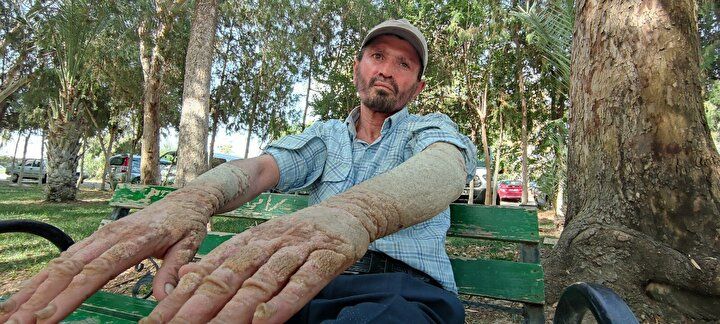 Hayatı kabusa döndü! Görenlerin kaçmasına alışamadı 6