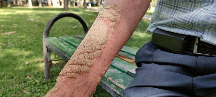 Hayatı kabusa döndü! Görenlerin kaçmasına alışamadı 7