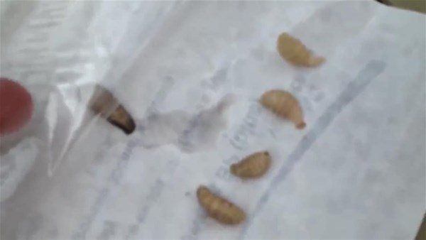 Sivilce zannetti doktora gitti! İçinden çıkanlar şoke etti 25