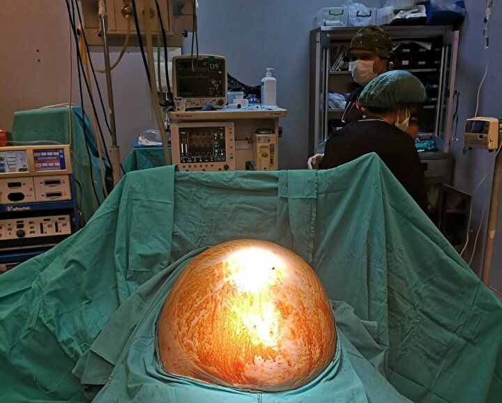 Enfeksiyon sandılar karnından bakın ne çıktı! 7