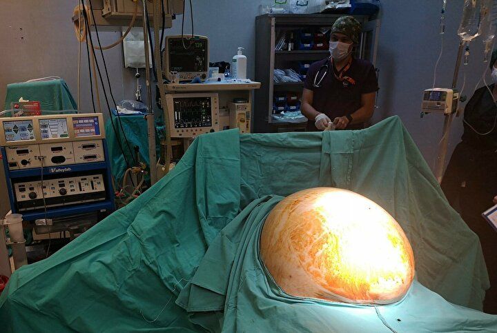 Enfeksiyon sandılar karnından bakın ne çıktı! 4