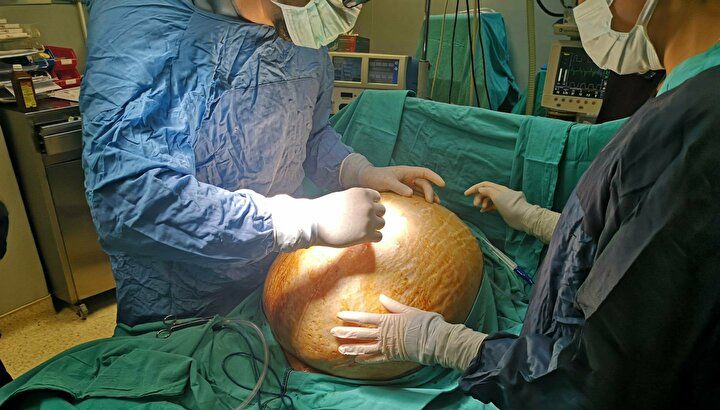 Enfeksiyon sandılar karnından bakın ne çıktı! 8