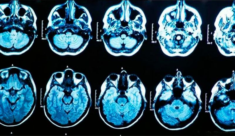 ABD basını yazdı: Gizemli hastalık yayılıyor, iki yeni vaka görüldü 6