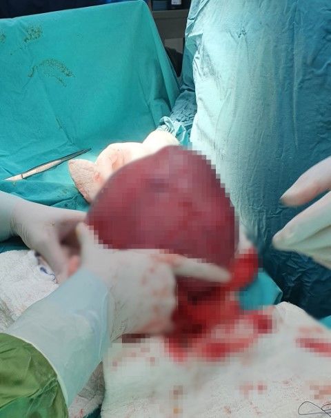 Karnından çıkartıldı! Kendisi bile bakmaya korktu... 5