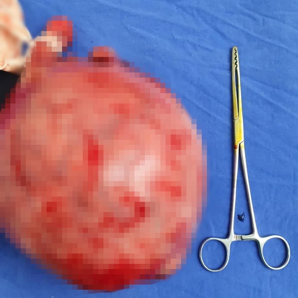 Karnından çıkartıldı! Kendisi bile bakmaya korktu... 6