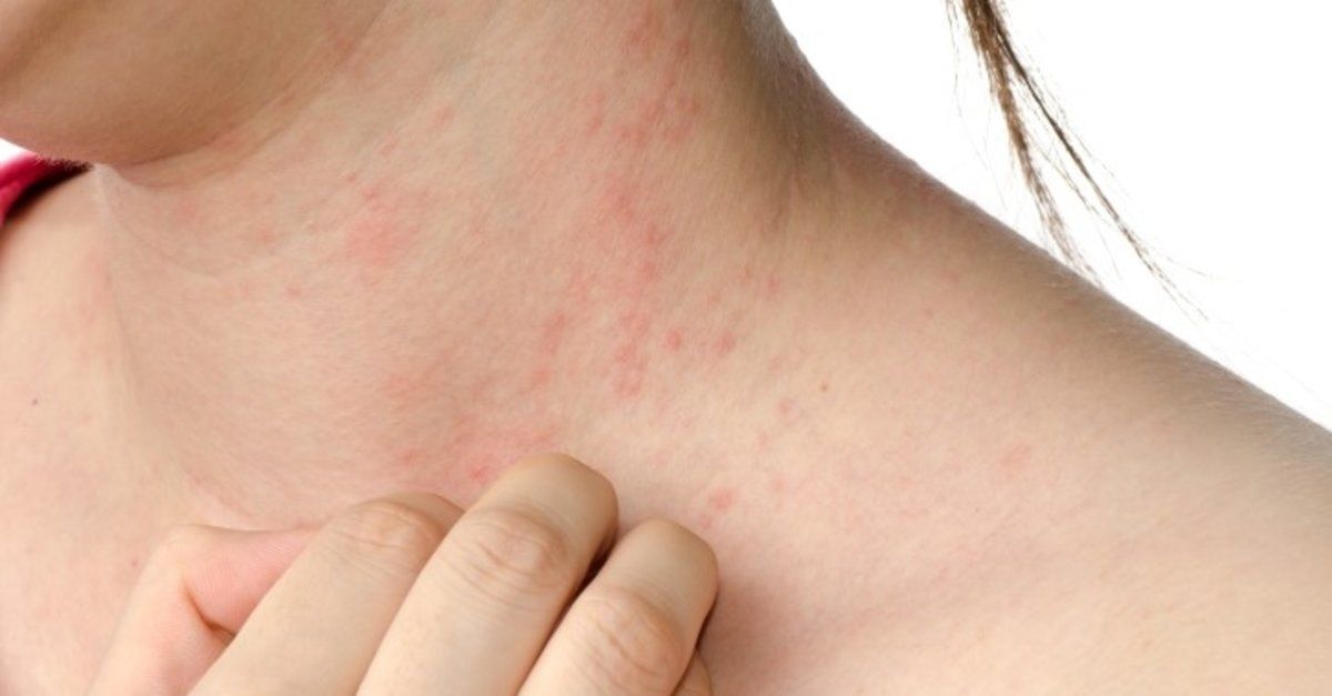 Vücudunuzda bu belirti varsa dikkat! Omicron varyantının yeni belirtisi 5