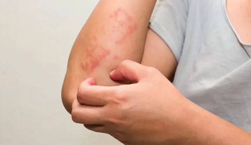 Vücudunuzda bu belirti varsa dikkat! Omicron varyantının yeni belirtisi 6