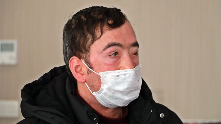 Türkiye'nin ilk yüz naklinin üzerinden 10 yıl geçti! 7