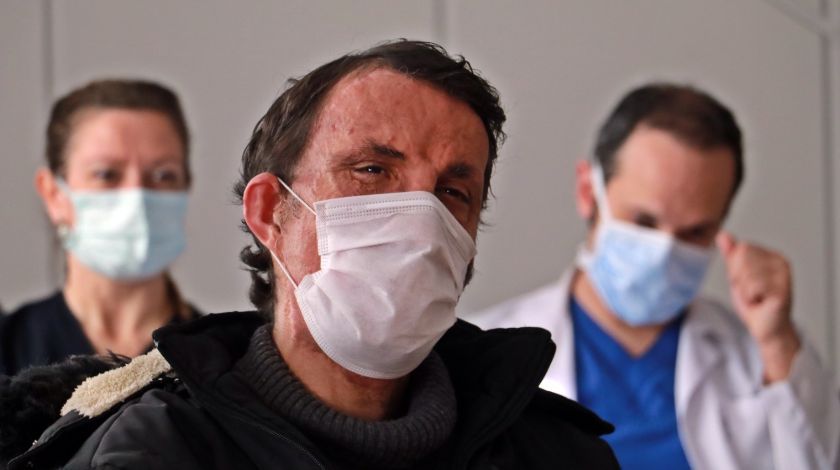 Türkiye'nin ilk yüz naklinin üzerinden 10 yıl geçti! 8