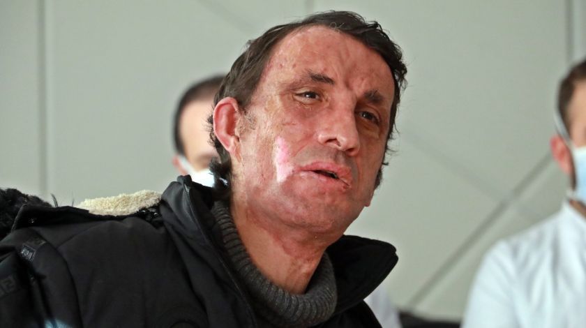 Türkiye'nin ilk yüz naklinin üzerinden 10 yıl geçti! 9