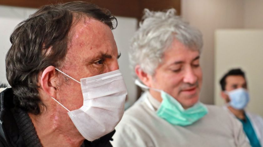 Türkiye'nin ilk yüz naklinin üzerinden 10 yıl geçti! 11