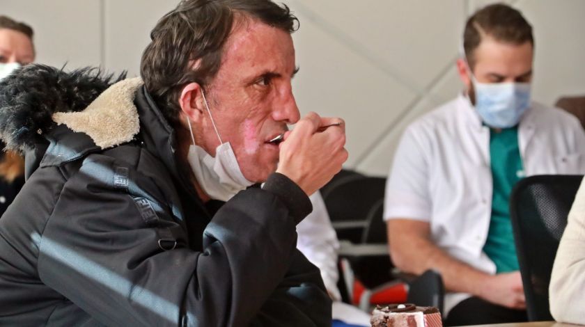 Türkiye'nin ilk yüz naklinin üzerinden 10 yıl geçti! 12