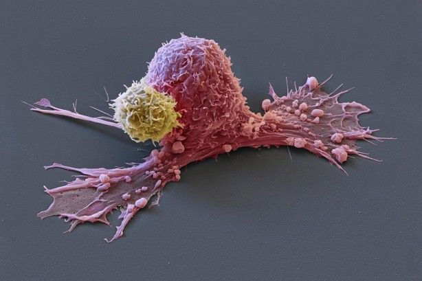 İşte Ramazan'da oruç tutmanın faydaları... 10