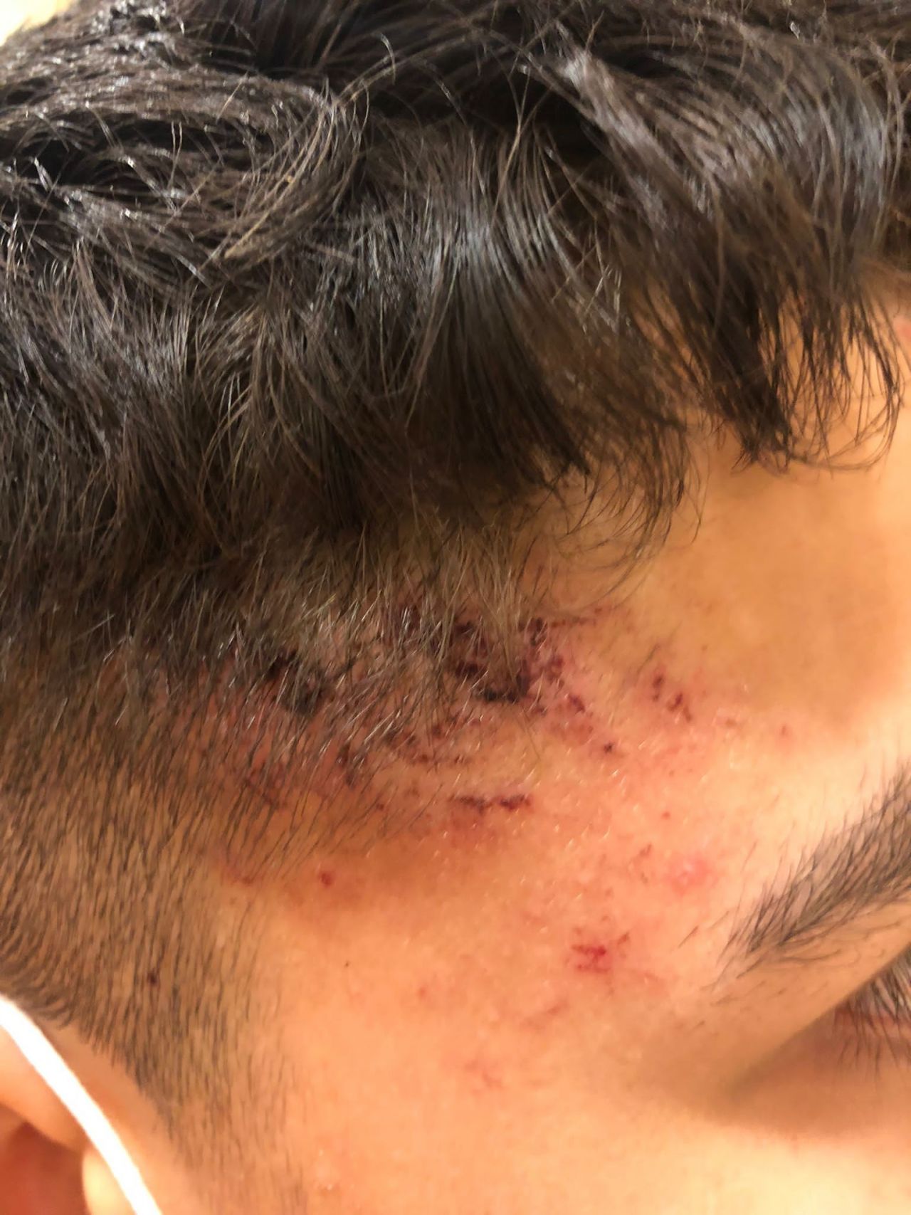 Almanya’da 13 yaşındaki Emirhan Altıntaş’a polis şiddeti kamerada 2