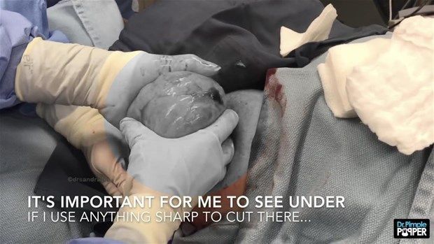 Boynundan çıkan şey şoke etti 13