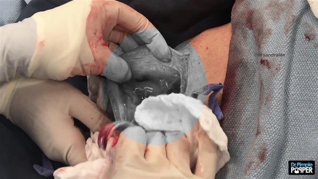 Boynundan çıkan şey şoke etti 20