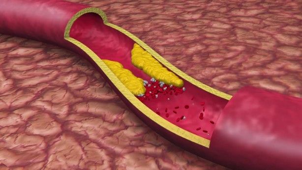 Canan Karatay öneriyor! Bu besinlere sofranızda mutlaka yer verin 6