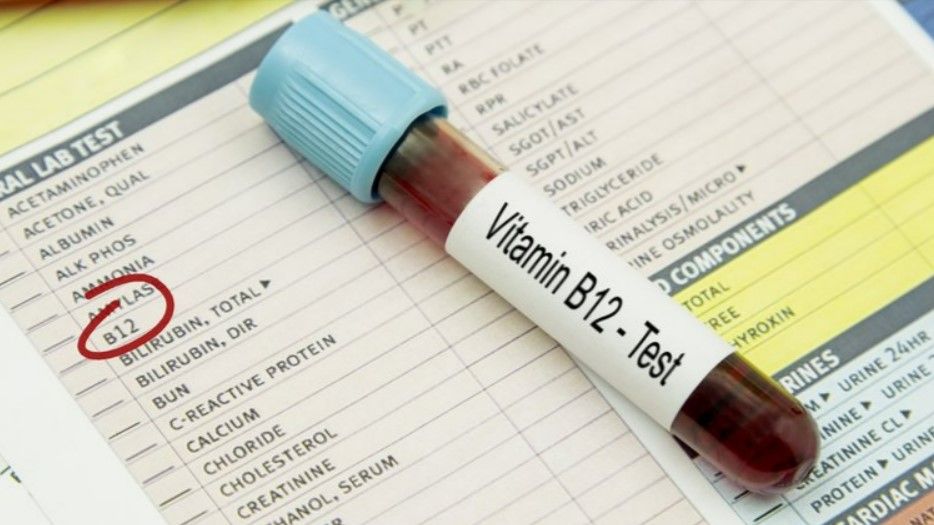 Uzmanlar açıkladı! İşte B12 vitamin eksikliğinin ilk belirtisi 2