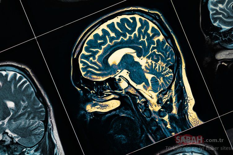 Uzmanlar açıkladı! İşte B12 vitamin eksikliğinin ilk belirtisi 23