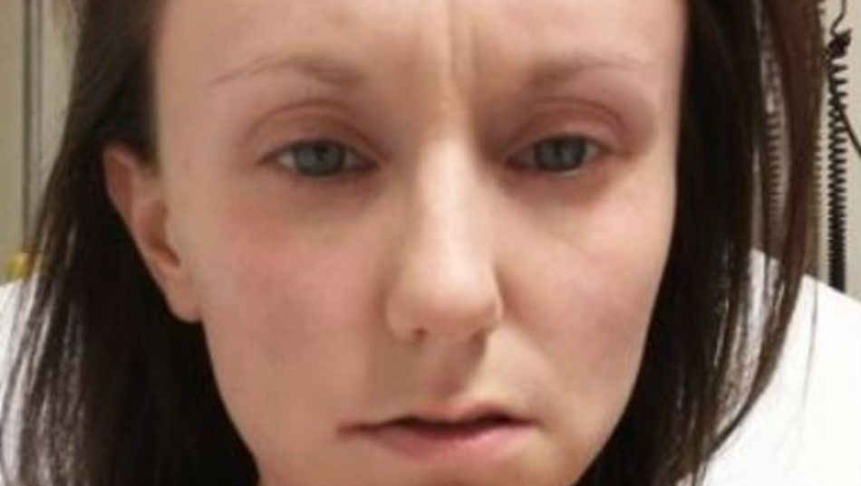 Böcek ısırığı hayatını mahvetti! Sadece 5 gıda ile hayatta kalmaya çalışıyor: Vücudum eriyor sandım 1