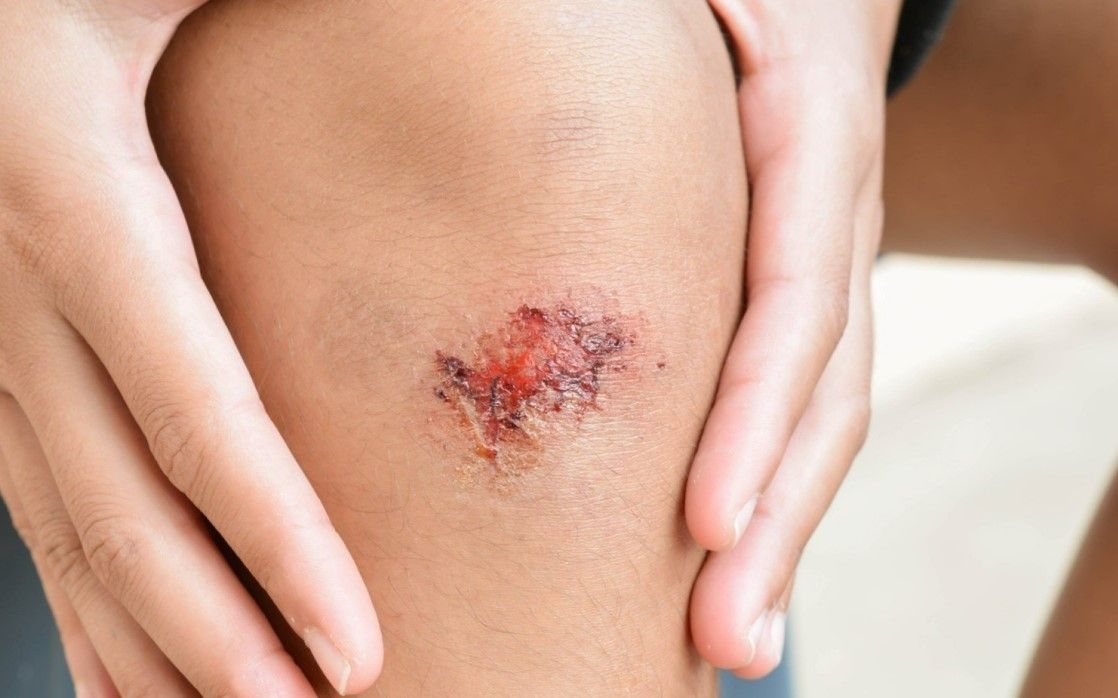 Kanser vücutta oluştuğu an bu belirtiyi veriyor! İşte kanserin ilk belirtisi 18