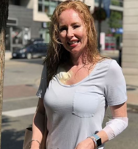 Egzama sandığı lekeler cilt kanseri çıktı! Herkesi uyarıyor: Bu hatayı yapan herkes risk altında… 2