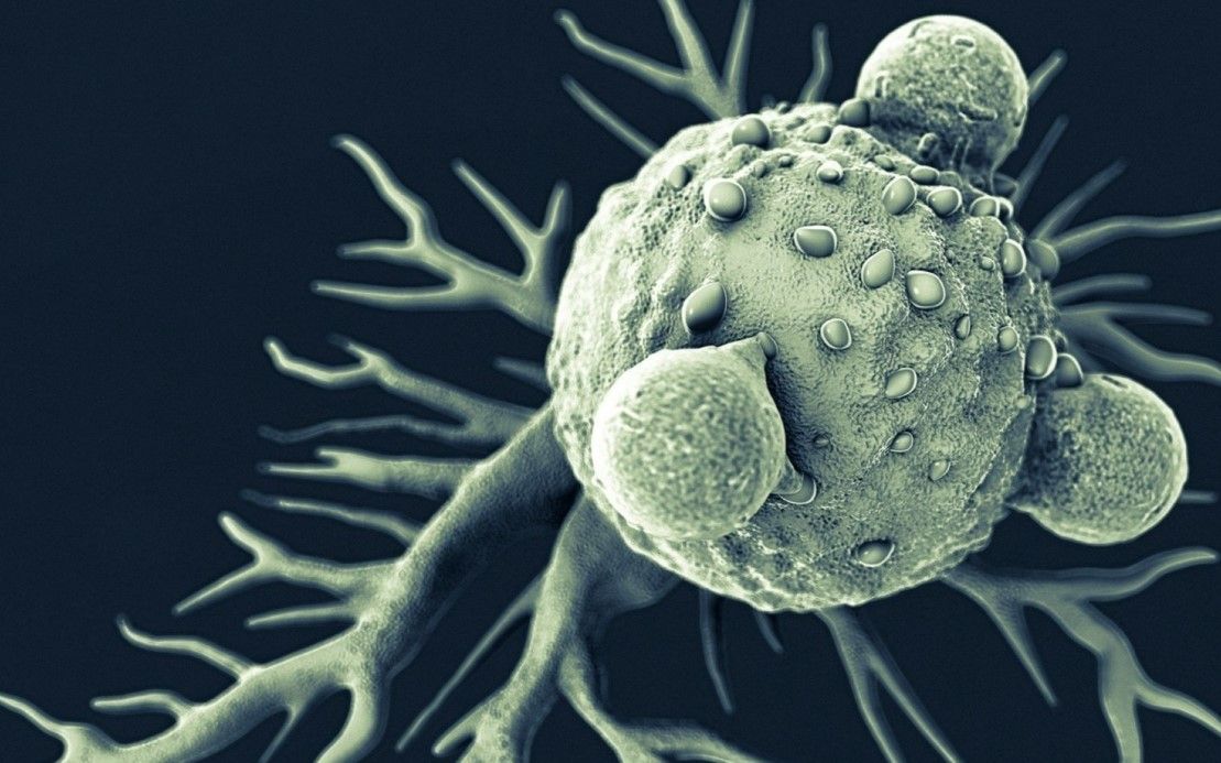 Kanser vücutta oluştuğu an bu belirtiyi veriyor! İşte kanserin ilk belirtisi 20