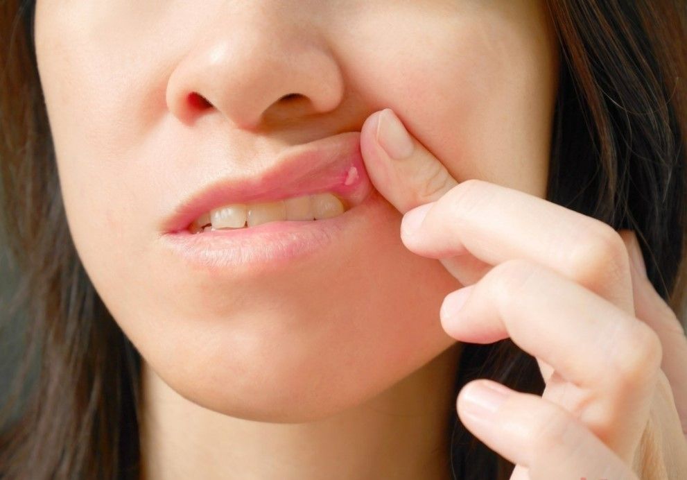 Kanser vücutta oluştuğu an bu belirtiyi veriyor! İşte kanserin ilk belirtisi 29