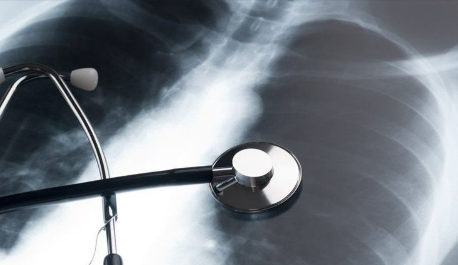 Akciğerleri hızla baştan sona temizliyor! Bu besin doğal antibiyotik gibi 1