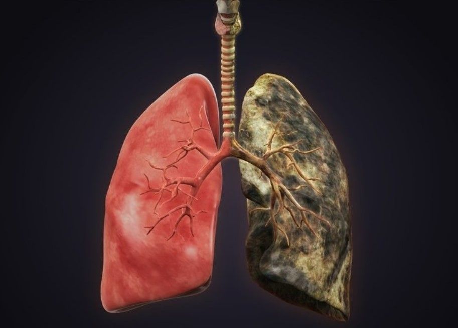 Akciğerleri hızla baştan sona temizliyor! Bu besin doğal antibiyotik gibi 2