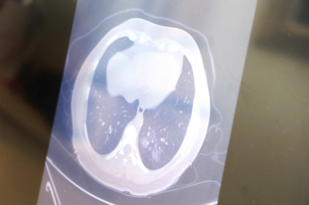 Dikkat çeken uyarı! 'Korona vakaları azaldı, o salgın başladı' 2