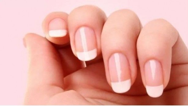 Tırnaklardaki siyah çizgilere dikkat: Uzmanı uyardı! 4