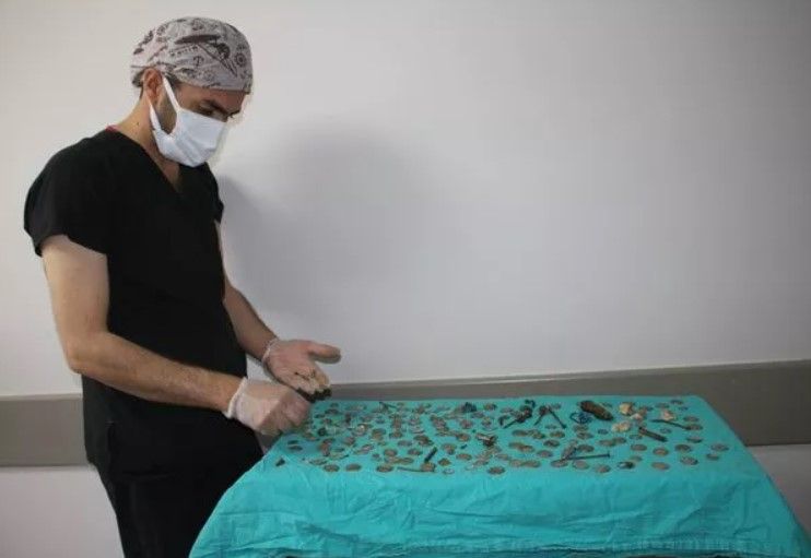 Midesinden çıkanları görenler şoke oldu! 83 tane 1 lira... 2