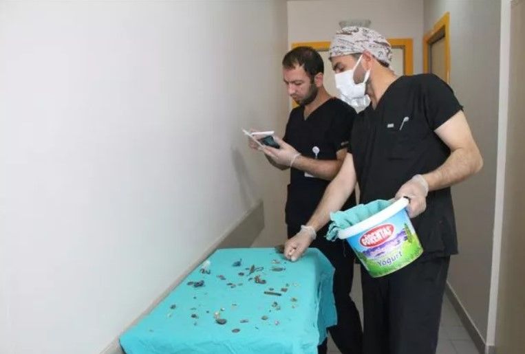 Midesinden çıkanları görenler şoke oldu! 83 tane 1 lira... 3