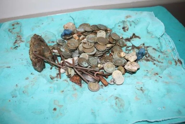 Midesinden çıkanları görenler şoke oldu! 83 tane 1 lira... 4