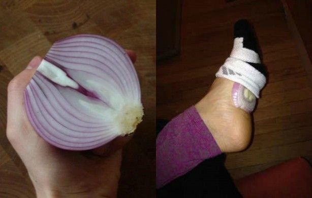 Çorabınızın için yarım soğan koyup sabaha kadar beklerseniz bakın ne olur? Herkes bunu yapıyor 2