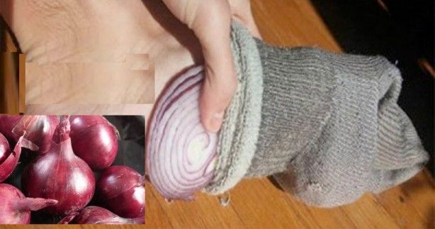 Çorabınızın için yarım soğan koyup sabaha kadar beklerseniz bakın ne olur? Herkes bunu yapıyor 4