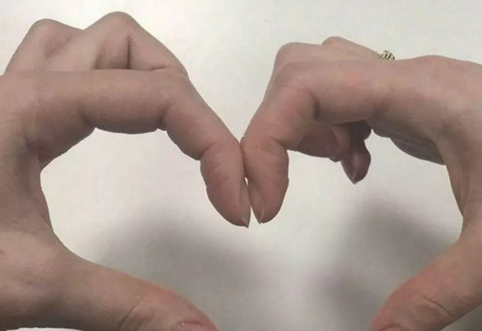 Basit tırnak testi ile kanseri önceden teşhis etmeniz mümkün! Akciğer kanseri için önemli bir adım 1