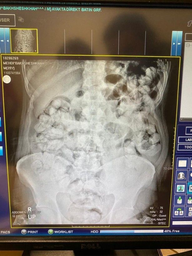 Böylesi görülmedi! Doktorlar şaşkın 1