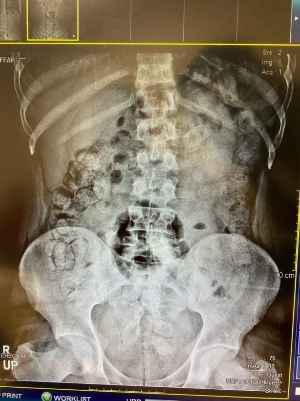 Böylesi görülmedi! Doktorlar şaşkın 5