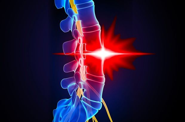 Bu 4 belirti varsa kesin bel fıtığınız var 8