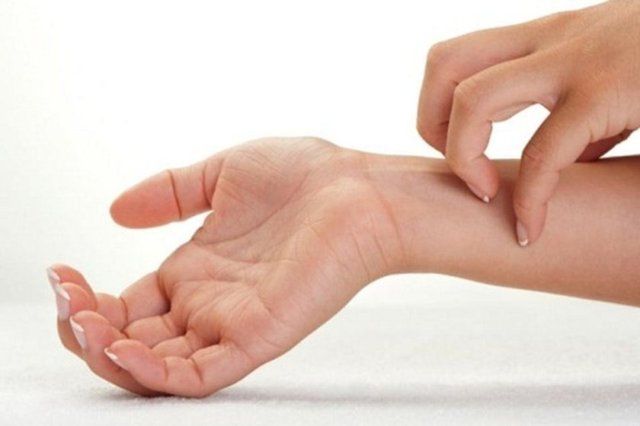 Sivrisinekler bazı insanları daha fazla ısırıyor: Nedeni aslında çok basit! 5