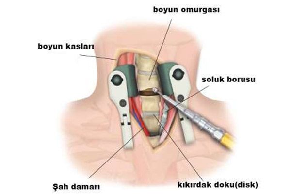 Bilgisayar ve telefonları uzun süre kullanırsanız bakın neler oluyor! Büyük tehlike... 7