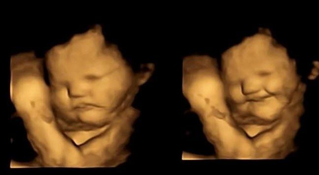 Bebekler, anne karnında yemek seçiyor! Lahanayı gören fetüsün yüzünü ekşitmesi gündem oldu! 1