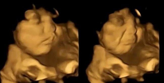 Bebekler, anne karnında yemek seçiyor! Lahanayı gören fetüsün yüzünü ekşitmesi gündem oldu! 2