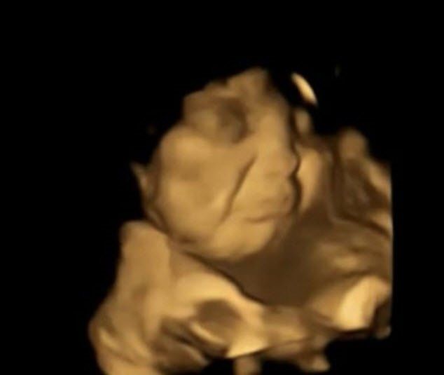 Bebekler, anne karnında yemek seçiyor! Lahanayı gören fetüsün yüzünü ekşitmesi gündem oldu! 3