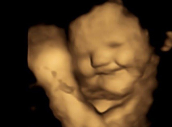 Bebekler, anne karnında yemek seçiyor! Lahanayı gören fetüsün yüzünü ekşitmesi gündem oldu! 4