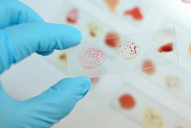 Kimisi olumlu kimisi olumsuz! Kan grubuna göre kişilik modelleri 10